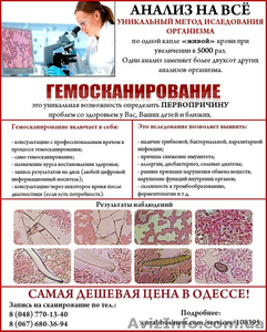 Анализ на ВСЕ по живой капли крови - <ro>Изображение</ro><ru>Изображение</ru> #1, <ru>Объявление</ru> #869756