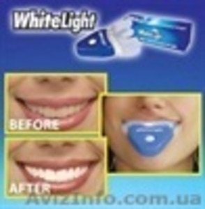 Отбеливание зубов в домашних условиях WHITE LIGHT - <ro>Изображение</ro><ru>Изображение</ru> #2, <ru>Объявление</ru> #914055
