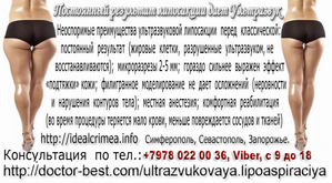 Ультразвуковая липосакция. Красивое тело всем к лицу!  