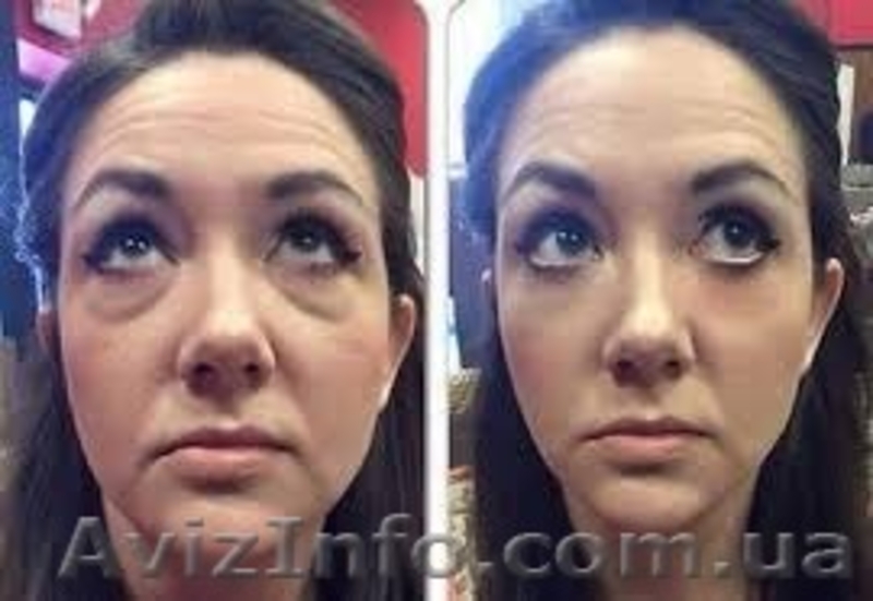 Крем от морщин мгновенного действия  Instantly Ageless - <ro>Изображение</ro><ru>Изображение</ru> #4, <ru>Объявление</ru> #1585453