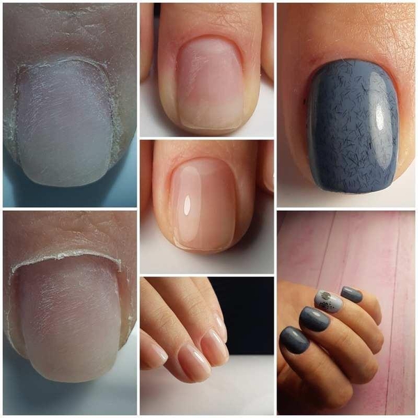 Маникюр, педикюр, гель-лак, косметология (пос. Котовского) - <ro>Изображение</ro><ru>Изображение</ru> #7, <ru>Объявление</ru> #1704084